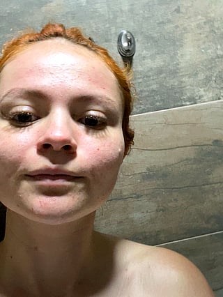 Curious Chick Shows Off Her Bumps'