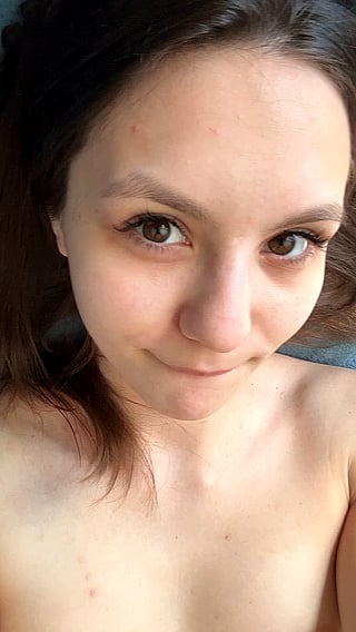 Amateur Teen OnlyFans: 'Is Enhancing My A Cups a Bad Idea?''