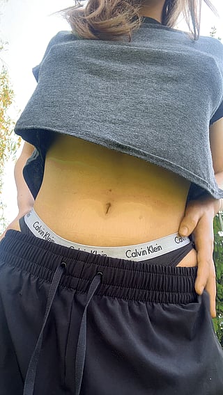 Reveal: A Bit Skinny, But It Can Be Fixed with Implants'