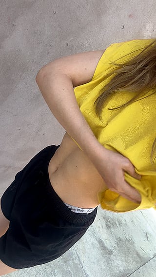 Reveal: How to Fix Saggy Belly at 20 Years Old'